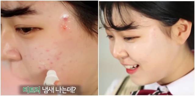 real skin patch怎么樣？real skin是什么牌子