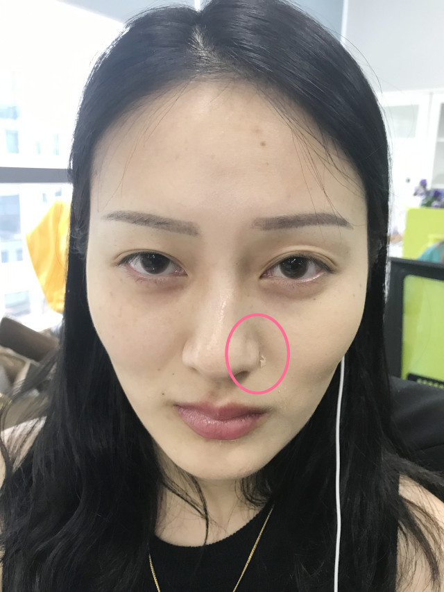 real skin patch怎么樣？real skin是什么牌子
