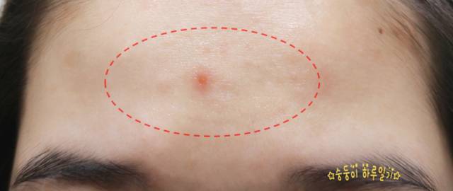 real skin patch怎么樣？real skin是什么牌子
