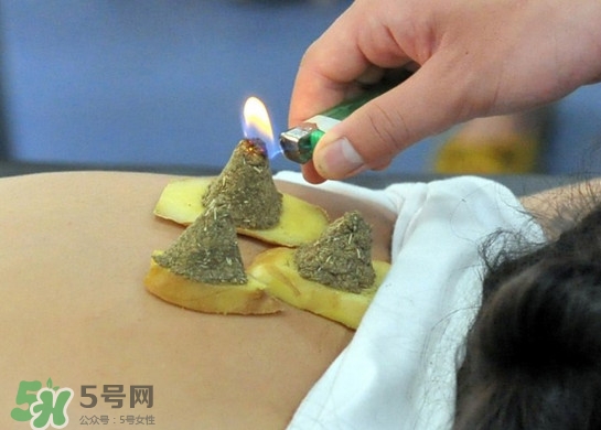 三伏灸灸哪里？三伏灸是每天都灸嗎