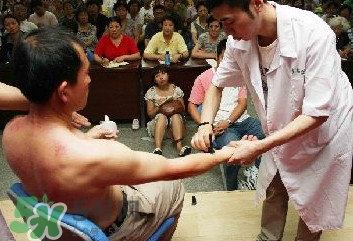刮痧痛嗎？刮痧疼還是拔罐疼