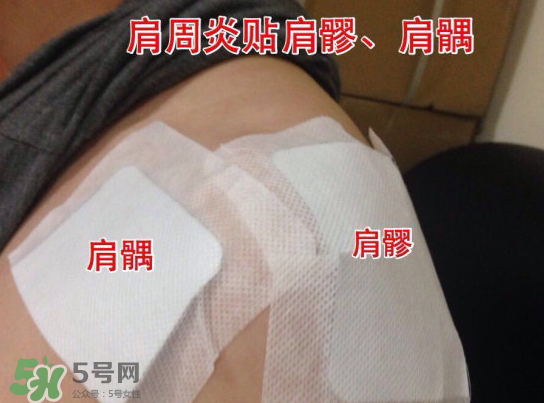 艾灸貼多少錢一盒?？艾灸貼一盒60裝多少錢？