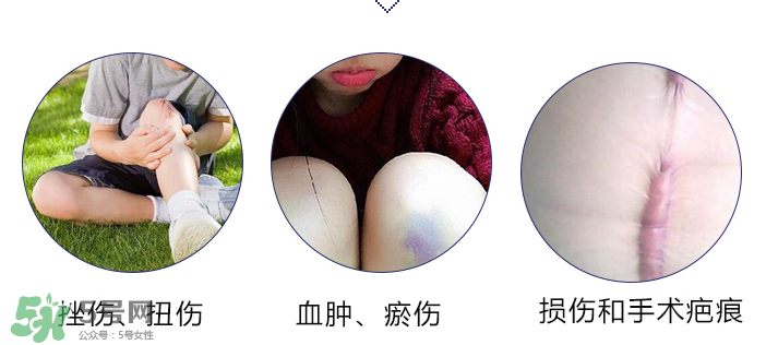 hirudoid除疤膏有效嗎？hirudoid去疤膏效果如何？