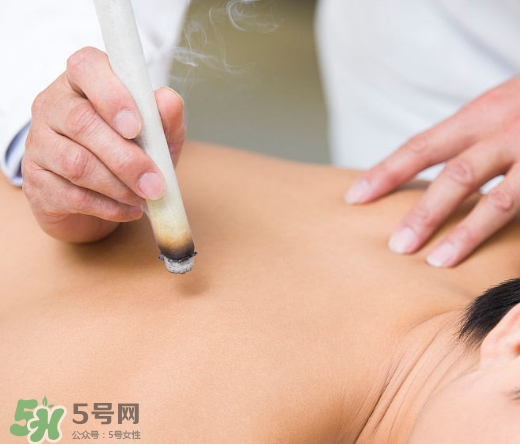 三伏貼和艾灸哪個(gè)好？三伏貼和艾灸區(qū)別