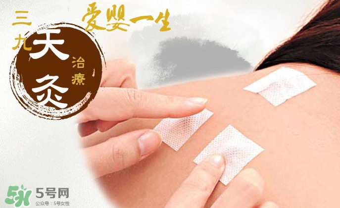 貼三伏貼可以吃魚嗎？貼三伏貼可以吃什么魚？