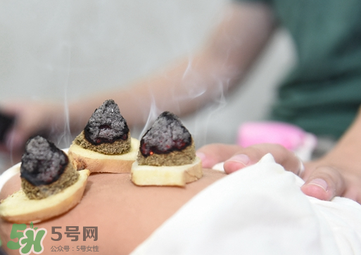 三伏灸什么人不能做？三伏灸適合哪些人？