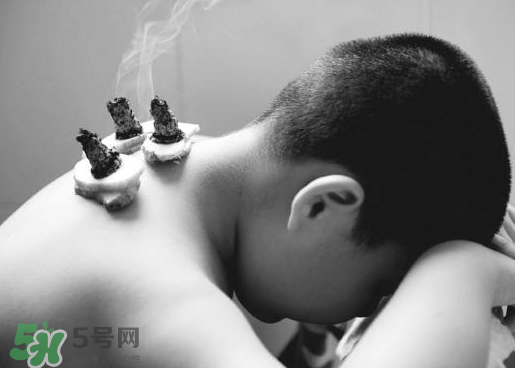三伏灸什么人不能做？三伏灸適合哪些人？