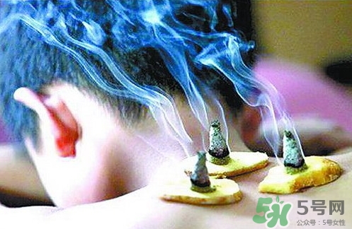三伏灸什么時(shí)候開始灸？三伏灸怎么灸？