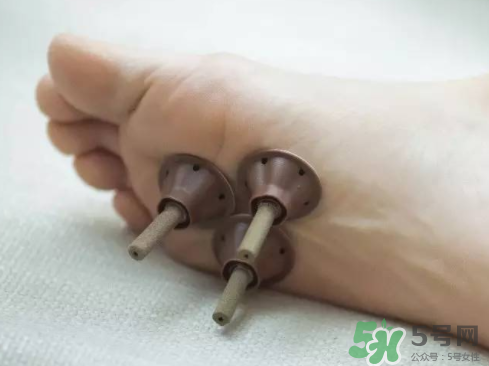 艾艾貼灸出水珠為什么？艾艾貼后有水珠要擦嗎？