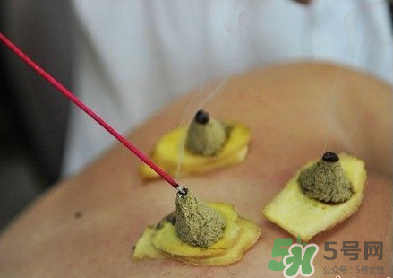 三伏灸可以自己灸嗎？三伏灸可以在家做嗎？