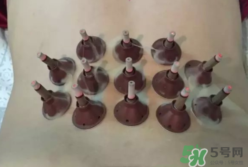 艾艾貼可以貼肚臍眼嗎？艾艾貼貼肚臍有什么作用？