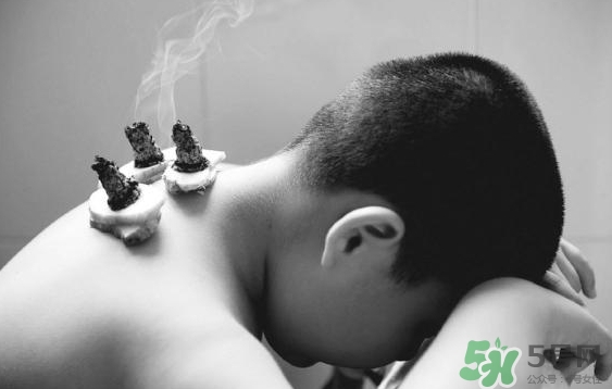 三伏灸要灸幾次？三伏灸要灸多久？