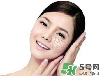 熱瑪吉是什么?熱瑪吉的原理是什么? 熱瑪吉是什么?熱瑪吉的原理是什么?