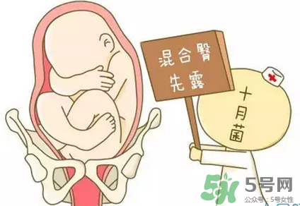 胎位不正能順產(chǎn)嗎？胎位不正怎么辦？