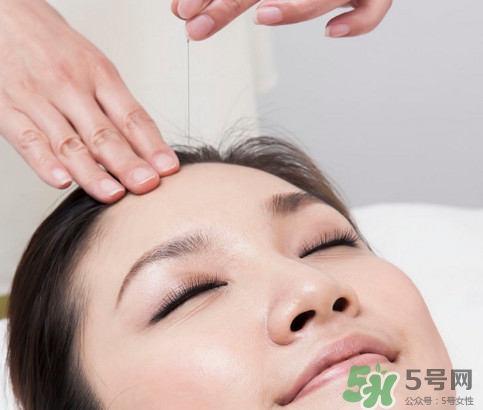 中醫(yī)院針灸一次多少錢(qián)？針灸后疼痛加重正常嗎