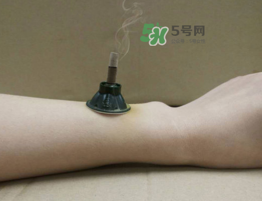 三伏天下雨可以艾灸嗎？三伏天下雨艾灸好嗎？