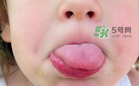三伏天為什么濕氣重？三伏天為什么要注意祛濕？