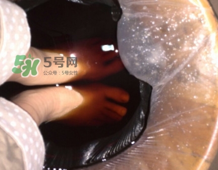 醋泡腳用白醋還是陳醋？泡腳用什么醋最好？