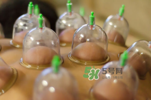 拔火罐是夏天好還是冬天好？什么時候拔火罐最合適？