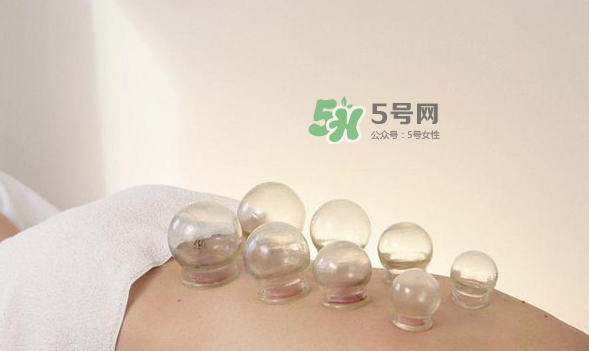 拔火罐是夏天好還是冬天好？什么時候拔火罐最合適？
