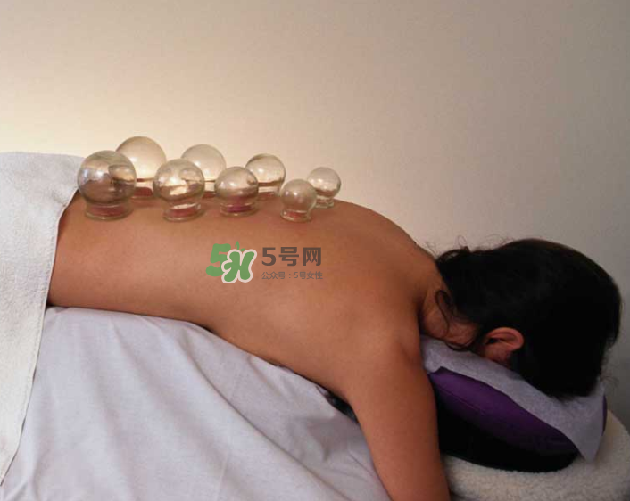 拔火罐一次多長時間？拔火罐一般多長時間？