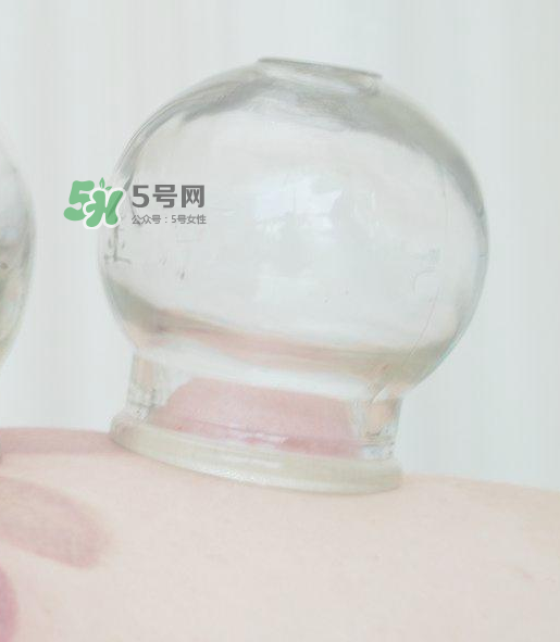 拔火罐一次多長時間？拔火罐一般多長時間？