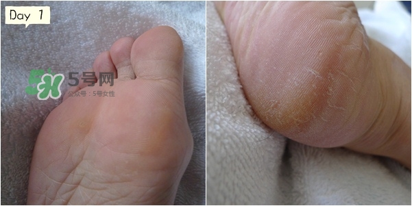 baby foot足膜怎么用？baby foot足膜使用方法
