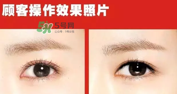 美瞳線有必要做嗎？做美瞳線多少錢？