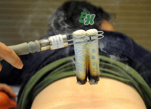 三伏天艾灸后能吹空調(diào)嗎？三伏天艾灸后能吹電扇嗎？
