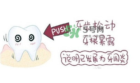 牙齒松動(dòng)會(huì)自己好嗎？牙齒松動(dòng)會(huì)自己掉嗎