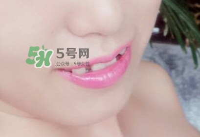 牙齒縫隙大怎么辦？牙縫大帶牙套有用嗎