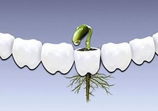 種植牙多少錢一顆？為什么種植牙很貴
