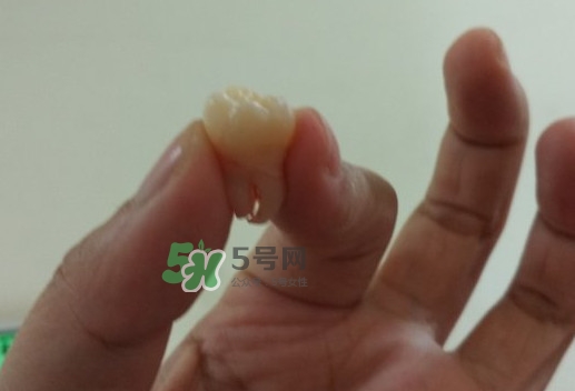 拔智齒痛嗎？智齒拔了多久洞會好？