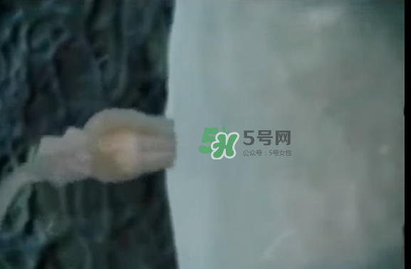 懷孕初期怎么保胎？陰道出血是流產(chǎn)征兆嗎？