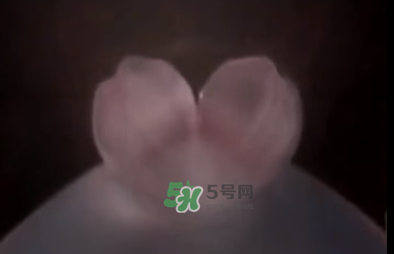 懷孕初期怎么保胎？陰道出血是流產(chǎn)征兆嗎？