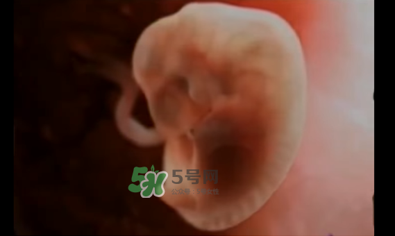 懷孕初期怎么保胎？陰道出血是流產(chǎn)征兆嗎？