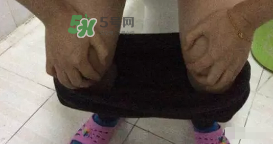 孕期可以蹲著上廁所嗎？孕期上廁所會壓到寶寶嗎？