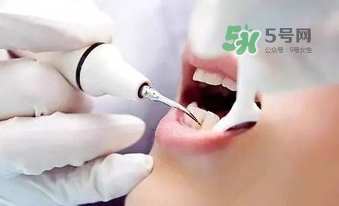 孕婦能矯正牙齒嗎？懷孕期間可以矯正牙齒嗎？