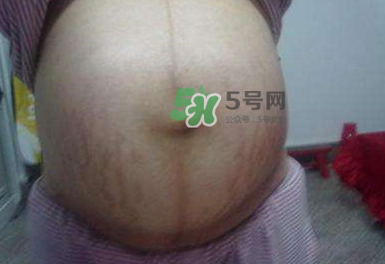 懷女孩肚子上會(huì)長(zhǎng)毛嗎？懷女孩肚子特征圖片