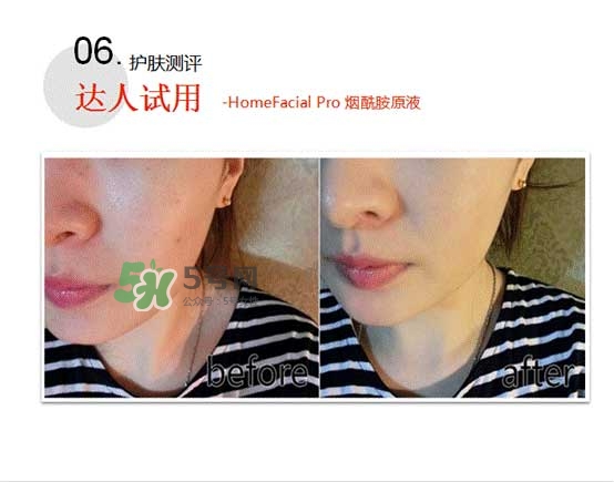 homefacialpro煙酰胺原液怎么樣？hfp煙酰胺原液好用嗎