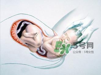 順產(chǎn)和剖腹產(chǎn)哪個(gè)好？順產(chǎn)和剖腹產(chǎn)哪個(gè)痛？