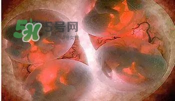 多胞胎是怎么生產(chǎn)的？多胞胎應選擇什么分娩方式
