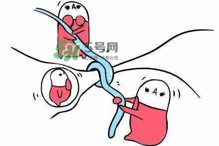 結(jié)扎好還是上環(huán)好？結(jié)扎上環(huán)哪個(gè)危害??？