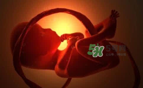 寶寶臍帶繞頸只能剖腹產(chǎn)嗎？胎兒臍帶繞頸孕婦有什么感覺