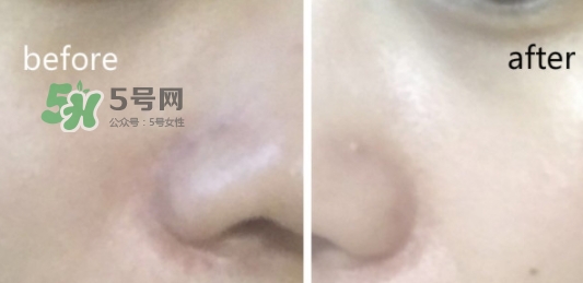 hr綠寶瓶新肌水怎么用？赫蓮娜綠寶瓶新肌水使用方法