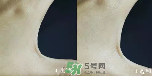 小黑瓶和小棕瓶可以一起用嗎？小棕瓶和小黑瓶哪個先用