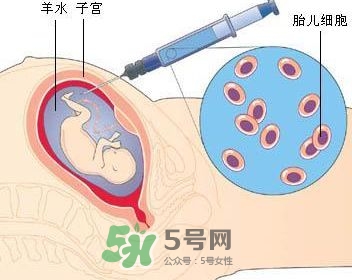 羊水栓塞是怎么回事？羊水栓塞怎么預防？