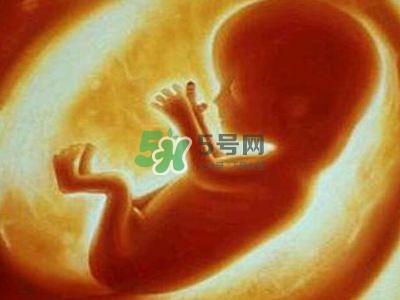 臍帶繞頸是什么原因造成的？臍帶繞頸是多休息還是多運動？