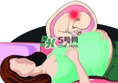 孕婦左側(cè)臥睡不著怎么辦？孕期左側(cè)睡不舒服怎么辦？