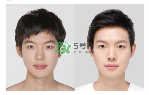 美白針有副作用嗎？美白針有什么副作用？